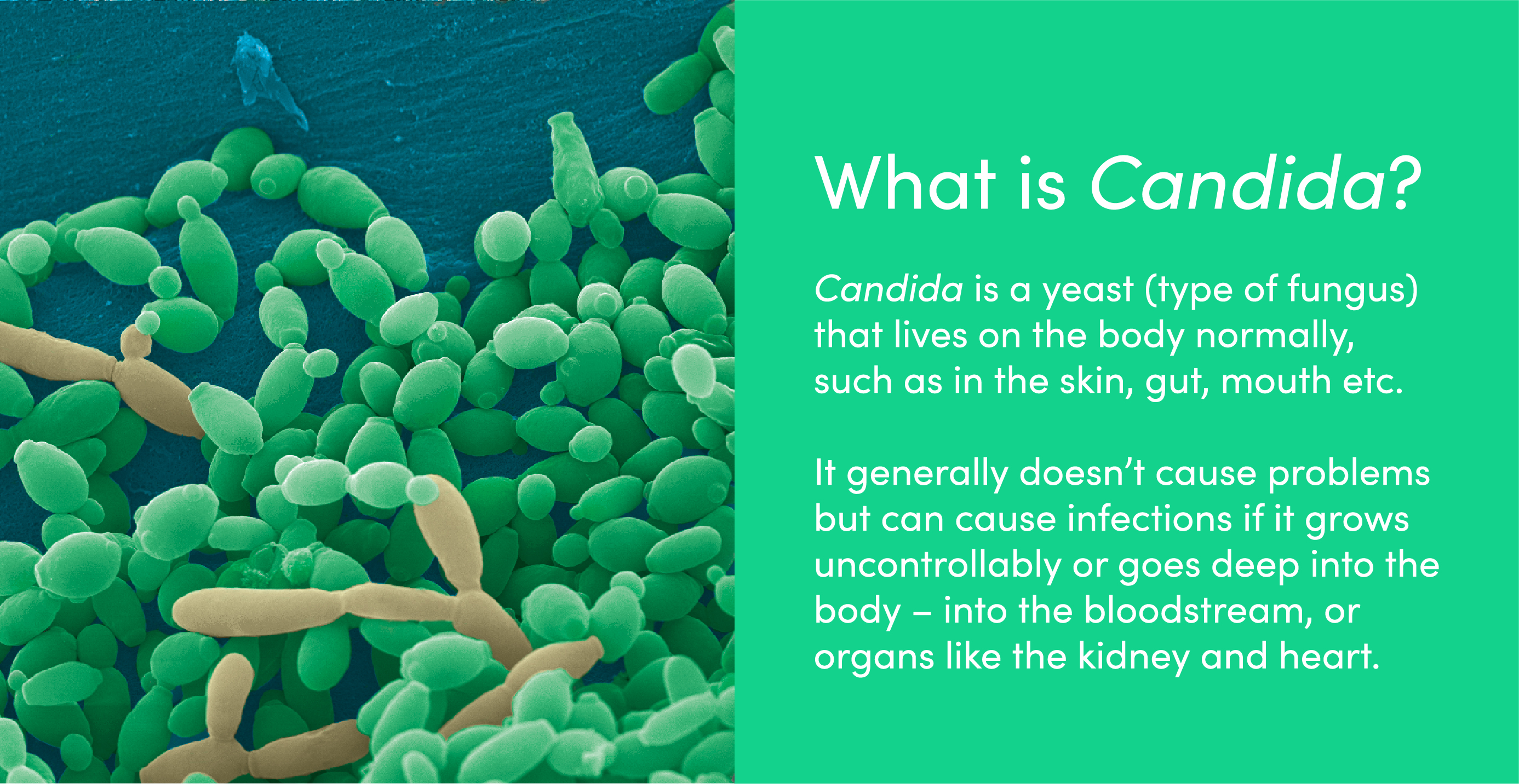 Candida is a yeast (type of fungus) that lives on the body normally. It generally doesn’t cause problems but can cause infections if it grows uncontrollably or goes deep into the body – into the bloodstream, or organs like the kidney and heart.